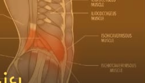 Mūl Bandh pelvic-floor exercise